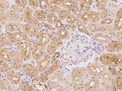 Immunohistochemistry-Paraffin: GLYCTK Antibody [NBP3-12587]
