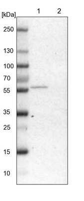 Western Blot: GLYCTK Antibody [NBP1-83292]