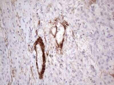 Immunohistochemistry: GM-CSF Antibody (OTI8G5) [NBP2-46364]