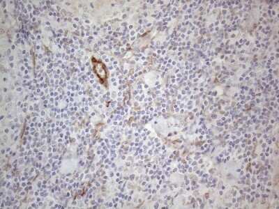 Immunohistochemistry: GM-CSF Antibody (OTI8G5) [NBP2-46364]
