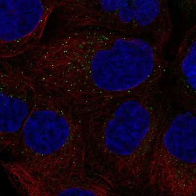 Immunocytochemistry/ Immunofluorescence: GM-CSF Antibody [NBP2-56096]