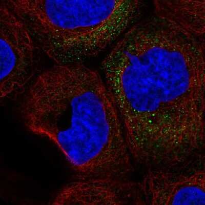 Immunocytochemistry/ Immunofluorescence: GM-CSF Antibody [NBP2-56177]