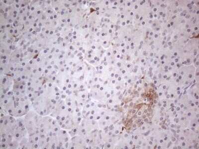 Immunohistochemistry: GM-CSF Antibody (OTI8G5) - Azide and BSA Free [NBP2-70462]