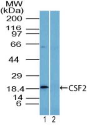 Western Blot: GM-CSF Antibody [NBP2-27161]