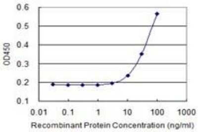ELISA: GM-CSFR alpha Antibody (2G5) [H00001438-M03]