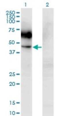Western Blot: GM-CSFR alpha Antibody (2G5) [H00001438-M03]