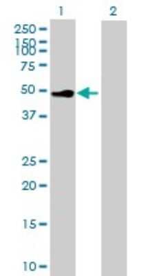Western Blot: GM-CSFR alpha Antibody [H00001438-B01P]