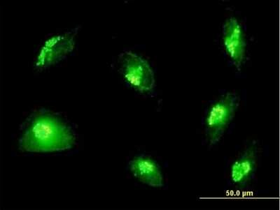 Immunocytochemistry/ Immunofluorescence: GM130/GOLGA2 Antibody [H00002801-B02P]
