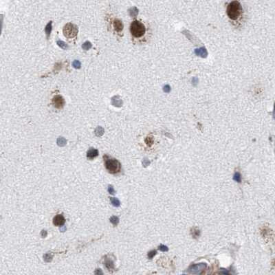 Immunohistochemistry-Paraffin: GM130/GOLGA2 Antibody [NBP1-89758]