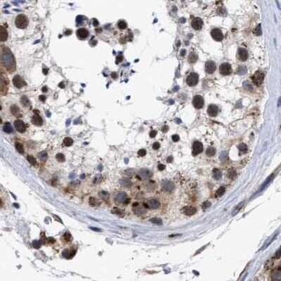 Immunohistochemistry-Paraffin: GM130/GOLGA2 Antibody [NBP1-89758]