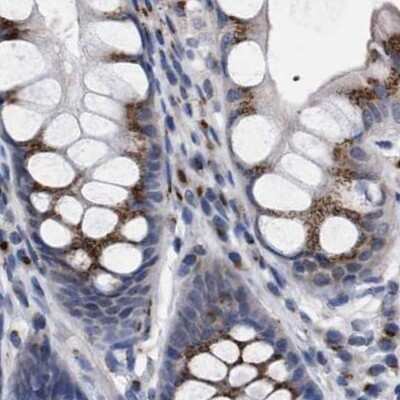 Immunohistochemistry-Paraffin: GM130/GOLGA2 Antibody [NBP1-89758]