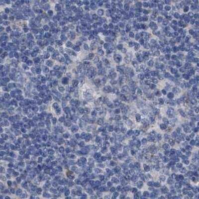 Immunohistochemistry-Paraffin: GM130/GOLGA2 Antibody [NBP1-89758]