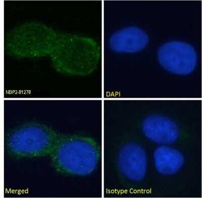Immunocytochemistry/ Immunofluorescence: GM2 Ganglioside Antibody (L55-81) - Chimeric - Azide and BSA Free [NBP2-81278]