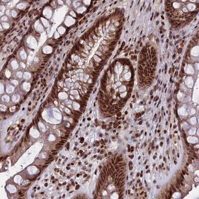 Immunohistochemistry-Paraffin: GMEB1 Antibody [NBP1-91949]