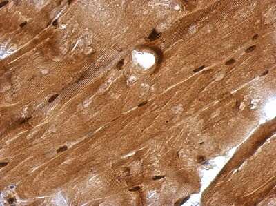 Immunohistochemistry-Paraffin: GMEB1 Antibody [NBP2-16694]