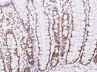 Immunohistochemistry-Paraffin: GMEB1 Antibody [NBP2-99588]