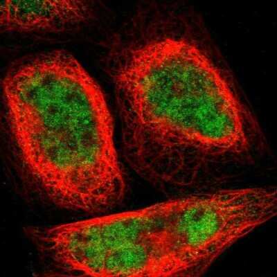 Immunocytochemistry/ Immunofluorescence: GMEB2 Antibody [NBP1-81421]