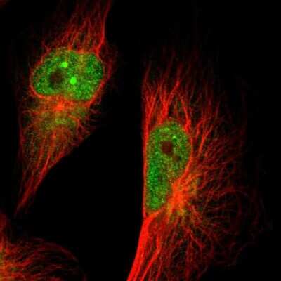 Immunocytochemistry/ Immunofluorescence: GMF-beta Antibody [NBP1-89755]
