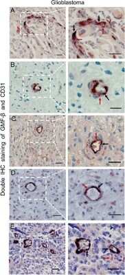 Immunocytochemistry/ Immunofluorescence: GMF-beta Antibody [NBP1-89755]