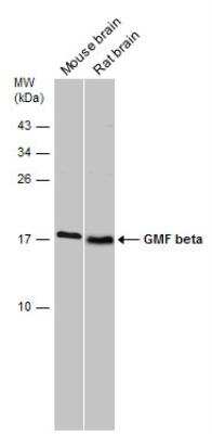 Western Blot: GMF-beta Antibody [NBP2-43647]
