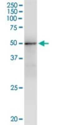 Immunoprecipitation: GMPPA Antibody (2F1) [H00029926-M01]