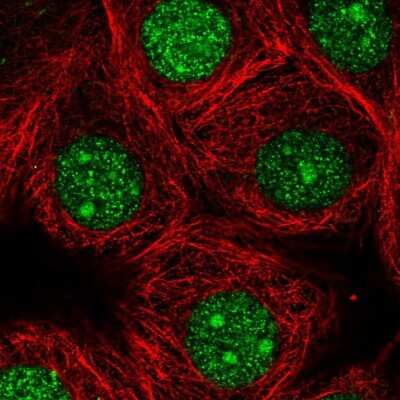Immunocytochemistry/ Immunofluorescence: GMPR2 Antibody [NBP2-55842]