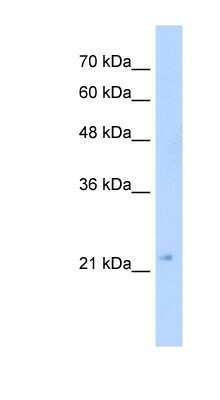 Western Blot: GMPR2 Antibody [NBP1-52837]