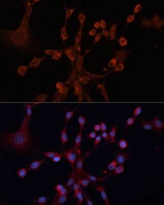 Immunocytochemistry/ Immunofluorescence: GNA14 Antibody - BSA Free [NBP3-05016]