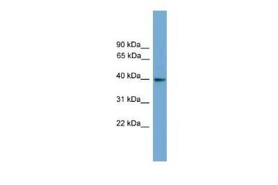 Western Blot: GNAI3 Antibody [NBP2-82234]