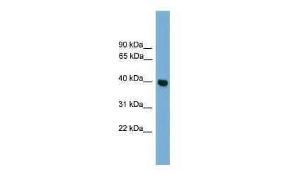 Western Blot: GNAI3 Antibody [NBP2-82235]