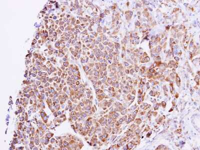 Immunohistochemistry-Paraffin: GNAL Antibody [NBP1-32225]