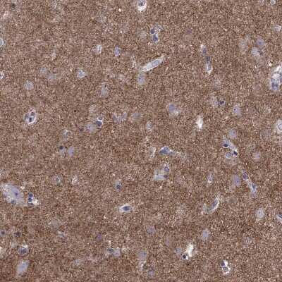 Immunohistochemistry: GNAL Antibody [NBP2-68695]
