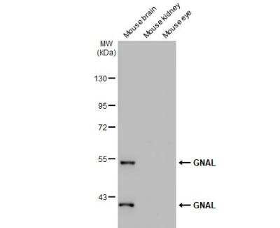 Western Blot: GNAL Antibody [NBP1-32225]