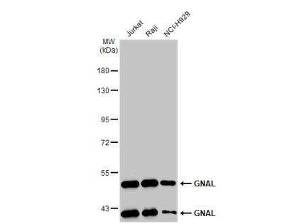 Western Blot: GNAL Antibody [NBP1-32225]