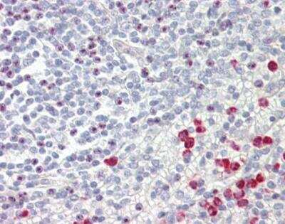Immunohistochemistry-Paraffin: GNAQ Antibody [NBP1-31985]