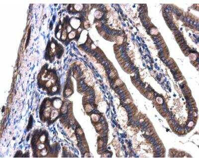 Immunohistochemistry-Paraffin: GNAQ Antibody [NBP1-31985]