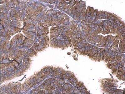 Immunohistochemistry-Paraffin: GNAQ Antibody [NBP1-31985]