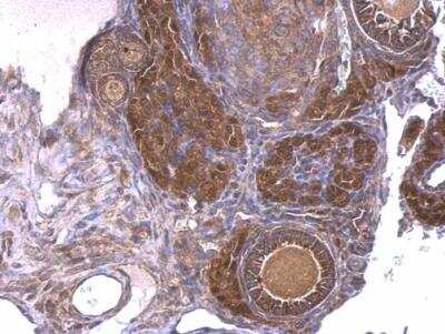 Immunohistochemistry-Paraffin: GNAQ Antibody [NBP1-31985]