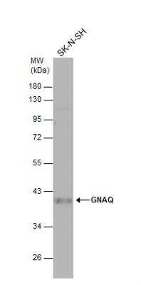 Western Blot: GNAQ Antibody [NBP1-31985]