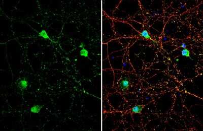 Immunocytochemistry/ Immunofluorescence: GNAT2 Antibody [NBP3-13378]