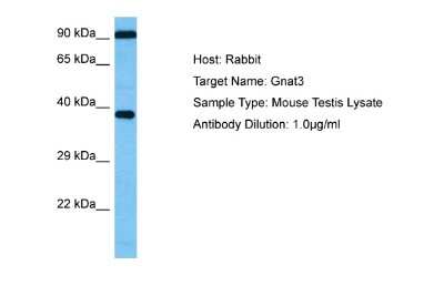 Western Blot: GNAT3 Antibody [NBP2-84050]