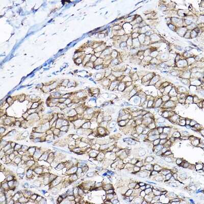 Immunohistochemistry-Paraffin: GNB2 Antibody - BSA Free [NBP3-04690]