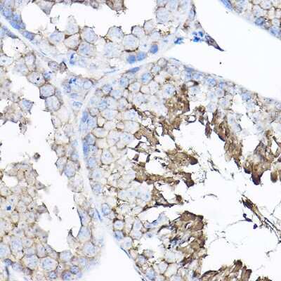 Immunohistochemistry-Paraffin: GNB2 Antibody - BSA Free [NBP3-04690]