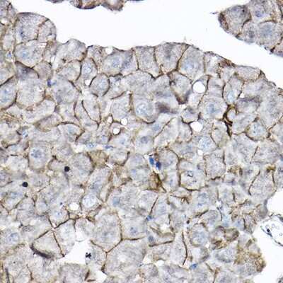 Immunohistochemistry-Paraffin: GNB2 Antibody - BSA Free [NBP3-04690]