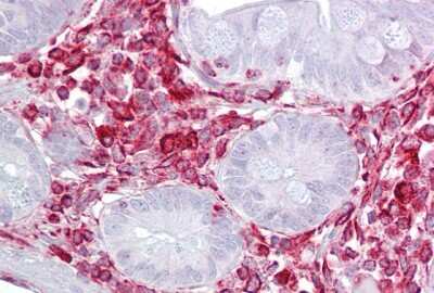 Immunohistochemistry-Paraffin: RACK1/GNB2L1 Antibody [NBP1-58959]
