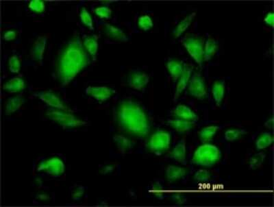 Immunocytochemistry/ Immunofluorescence: GNB3 Antibody (M1-1-1D5) [H00002784-M01]