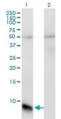 Western Blot: GNGT1 Antibody (1F8) [H00002792-M01]