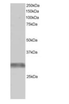 Western Blot: GNIP Antibody [NB100-1229]
