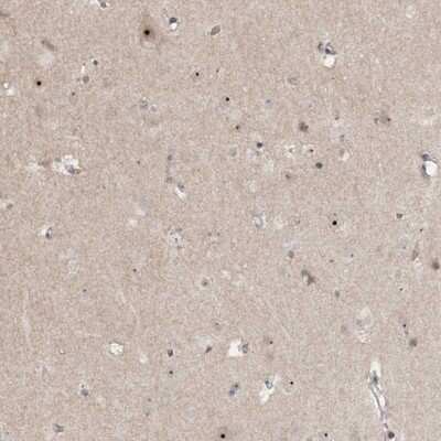 Immunohistochemistry: GNL3L Antibody [NBP2-32660]