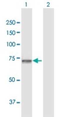Western Blot: GNPAT Antibody [H00008443-D01P]